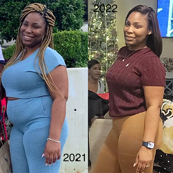 before and after Dr. Abtahi patient results